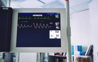 ECG monitor in a hospital